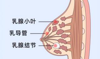 乳腺结节是怎么回事