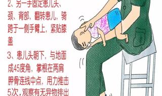 海姆立克急救法图解